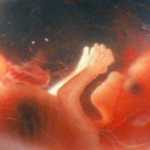 Cuando el feto empieza a sentir dolor