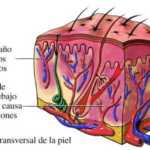 Moretones o hematomas