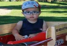 Problemas de la vista de un bebé