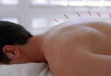 Beneficios de la acupuntura