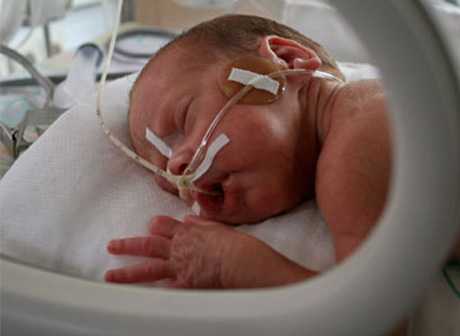 Complicaciones en bebés prematuros