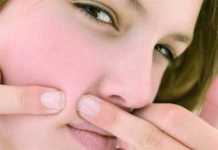 Yves Rocher, piel sin imperfecciones con su línea anti-acné