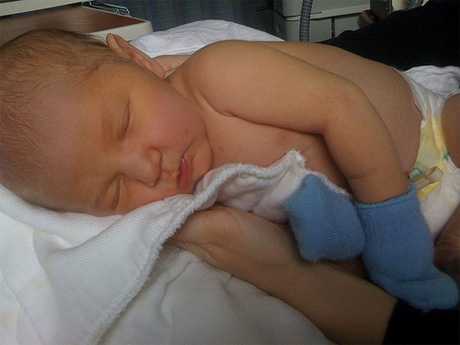 Ictericia fisiológica en bebé 