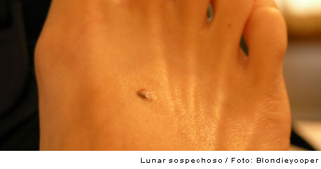 lunar maligno lunar maligno