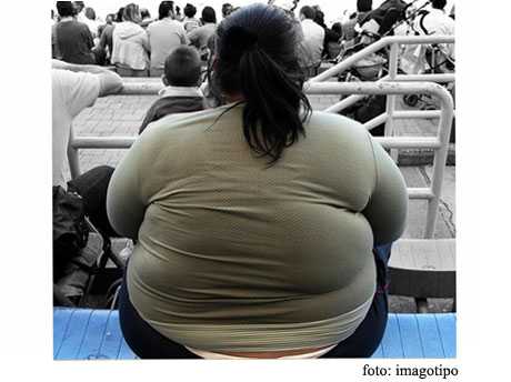 Obesidad