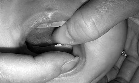 Molestias de Dentición