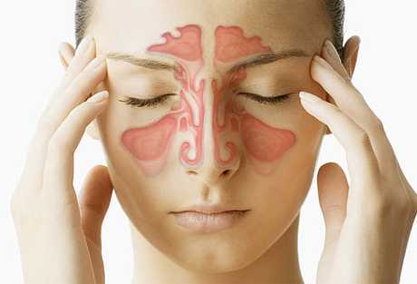 Cuidados sobre la sinusitis